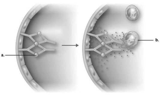<strong>Figure 19.1 In immune complex reaction shown in Figure 19.1,what is the end result of the reaction?</strong> A)IgG is directed against cell membrane antigens. B)Complement is activated. C)Neutrophils are attracted and release enzymes. D)Endothelial cells are damaged. E)Antibodies destroy neutrophils.