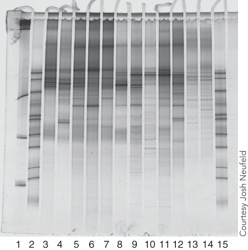 <strong>Which two lanes appear to have DNA from the most closely related or identical microbes/populations? </strong> A)Lanes 3 and 4 B)Lanes 4 and 5 C)Lanes 5 and 6 D)Lanes 8 and 9 E)Lanes 12 and 14