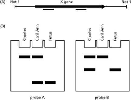 Assume that defects in a hypothetical gene X have been linked to a disease.Two copies of a defective gene X will predispose a child to the disease, while a single copy of the gene seems to produce no symptoms.Because early treatment can counteract the effects of the disease, a program of voluntary genetic testing is being performed with prospective parents.Caril Ann is pregnant with Charles's child.You obtain DNA samples from Charles, Caril Ann, and the fetus.You conduct PCR from these DNA samples using two different primer sets that will detect two commonly found deletions in gene X that are associated with the disease.The gene and location of these primer sets are shown in Figure 10-61A.Your results are shown in Figure 10-61B. Figure 10-61 A.Which of the three individuals have defects in gene X? B.Which individuals have a single defective gene and which have two defective copies of the gene? C.Indicate the location of each individual's defects on gene X.
