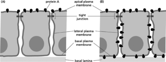 <strong>Consider the apical location of a particular protein expressed in epithelial cells, illustrated in part A of Figure 11-35.Which type of defect described below is the most likely to cause the redistribution of that protein around the entire cell, shown in part B of Figure 11-35 Figure 11-35</strong> A)a nonfunctional protein glycosylase B)the deletion of a junctional protein C)the truncation of a protein found in the extracellular matrix D)a nonfunctional flippase