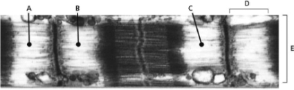 <strong>Figure 17-38 shows an electron micrograph of a skeletal muscle fiber, where various points along a fiber and various regions have been labeled.   Figure 17-38 Which of the following statements is TRUE about muscle contraction?</strong> A)Point A will move closer to point B. B)Point B will move closer to point C. C)Region D will become smaller. D)Region E will shrink in size. <div style=padding-top: 35px> 