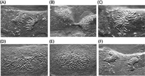 Figure 18-10 shows a living cell from the lung epithelium of a newt at different stages in M phase.Order these light micrographs into the correct sequence and identify the stage in M phase that each represents. Figure 18-10