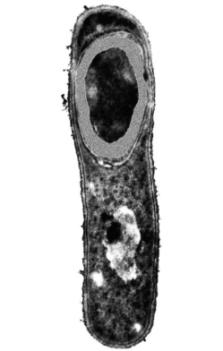 The bacterium in the figure contains a(n):  