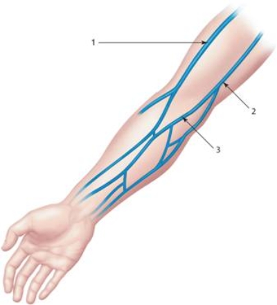 Number 1 in the picture is the ________vein, a vein commonly used for venipuncture.