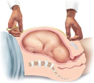 <strong>The nurse is measuring the fundal height of a patient who is at 28 weeks' gestation using the following method. What would be considered a normal finding? </strong> A) 22 c m B) 24 c m C) 28 c m D) 30 c m