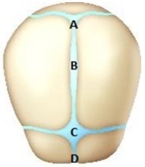 <strong>The nurse is reviewing educational material on newborn care with a patient in the 3<sup>rd</sup> trimester of pregnancy. Which area on the following diagram should the nurse point out as being the anterior fontanelle? </strong> A) A B) B C) C D) D