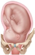 <strong>A pregnant patient's fetus is in the left-occiput-transverse position. Which diagram should the nurse use to explain this position to the patient?</strong> A) B) C) D)