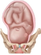 <strong>A pregnant patient's fetus is in the left-occiput-transverse position. Which diagram should the nurse use to explain this position to the patient?</strong> A) B) C) D)