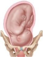 <strong>A pregnant patient's fetus is in the left-occiput-transverse position. Which diagram should the nurse use to explain this position to the patient?</strong> A) B) C) D)