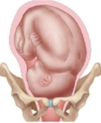 <strong>A pregnant patient's fetus is in the left-occiput-transverse position. Which diagram should the nurse use to explain this position to the patient?</strong> A) B) C) D)