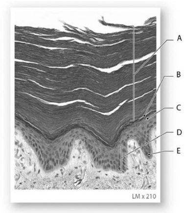 <strong> The lowest level of cells of the strata,marked E,consists of</strong> A)keratin protein. B)collagen fibers. C)dead cells. D)carotene-producing cells. E)mitotically active epithelial cells.