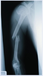 The figure below is an example of which of the following imaging technique(s)? I. x-ray II) magnetic resonance imaging III) computed tomography