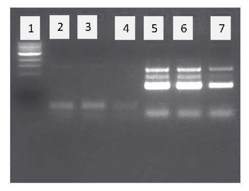 <strong>Which of the following choices most likely lists the sizes of the four DNA fragments in lane 6 (from top to bottom)of this agarose gel stained with ethidium bromide? (Note: The well that the DNA was loaded into is at the top of the gel image.) </strong> A)600 bp,450 bp,300 bp,100 bp B)100 bp,300 bp,450 bp,600 bp C)400 bp,300 bp,600 bp,100 bp D)300 bp,400 bp,100 bp,600 bp E)DNA fragment size can't be estimated using an agarose gel.