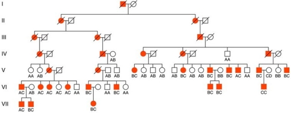 <strong>Examine this pedigree that shows segregation of Huntington disease and the DNA marker G8.What was the most likely genotype of individual V-3 at the DNA marker? </strong> A)BC B)AB C)CC D)AC E)All of the possible genotypes are equally likely.