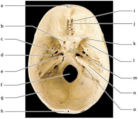   -What bony feature is labeled i?