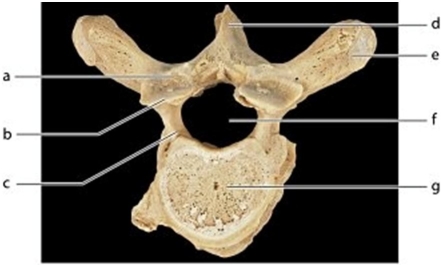   -Identify the bone marking labeled c.