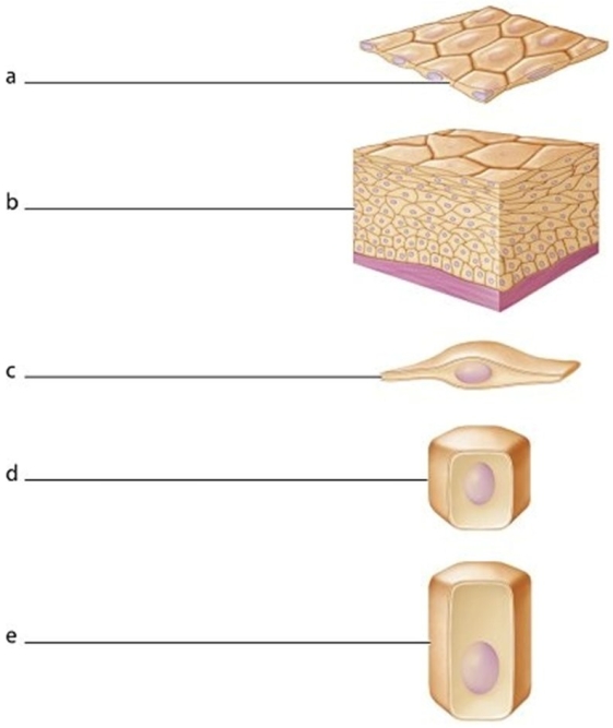   -Which best describes the cell labeled d?