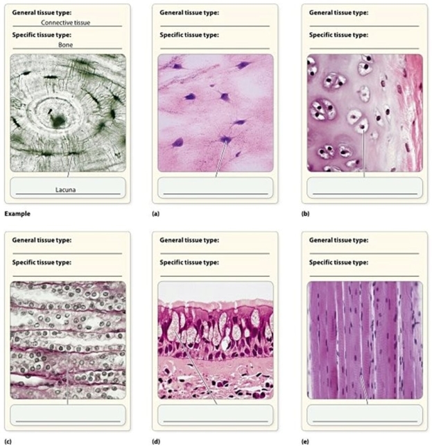-Which card shows a tissue containing ciliated cells and goblet cells?
