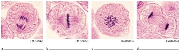 -Which image shows chromatin condensing to form chromosomes?