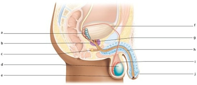   -Identify the structure labeled i.