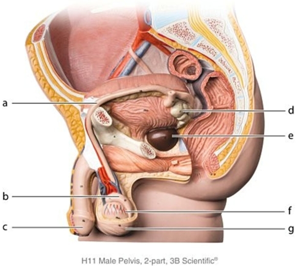   -Identify the structure labeled e.