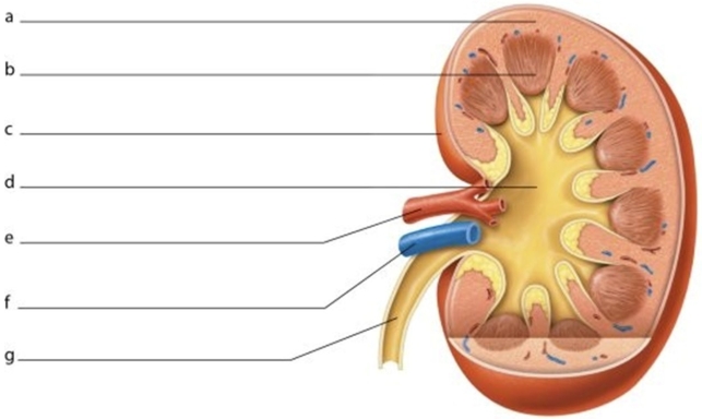   -Identify the structure labeled g.