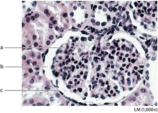   -Identify the structure labeled a.