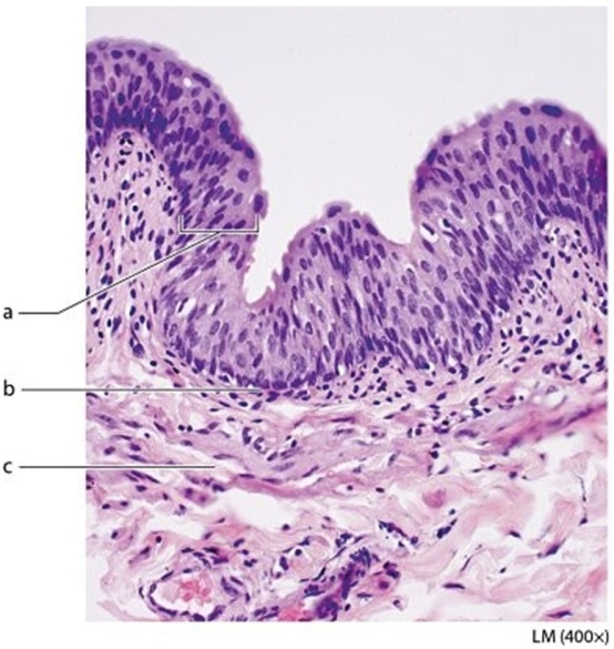   -What tissue type is found in the structure labeled a?