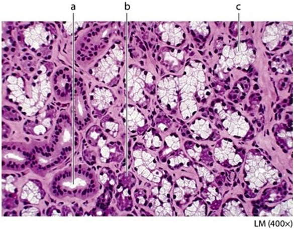 -Identify the structure labeled a in the photomicrograph.