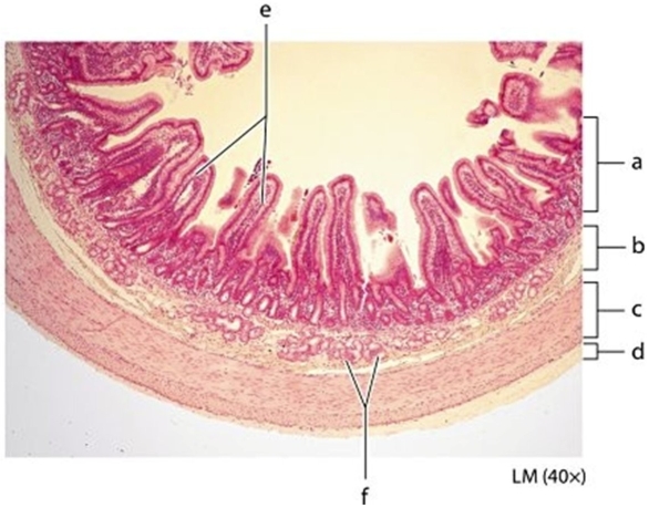   -What organ is shown in the photomicrograph?