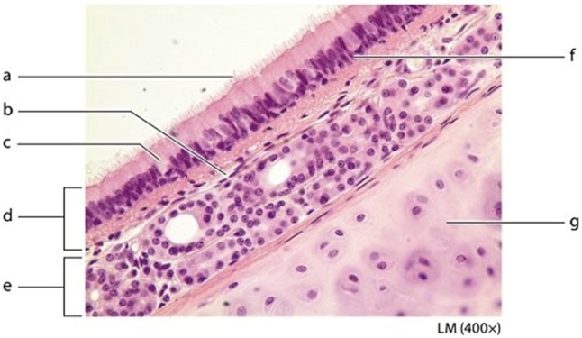 -On the photomicrograph, identify the structure labeled g.