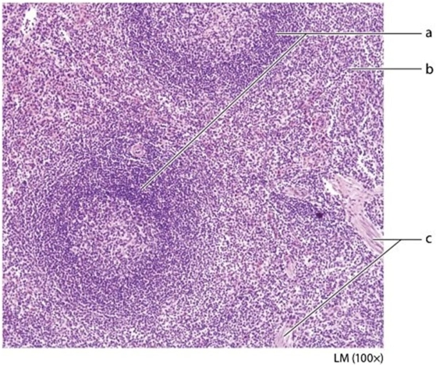 -Identify the structure on the photomicrograph labeled c.