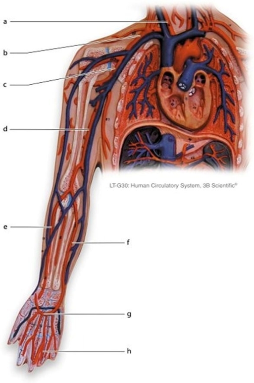   -Identify the vessel labeled f.