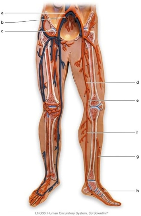   -Identify the vessel labeled f.