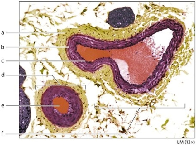   -Identify the structure labeled a.