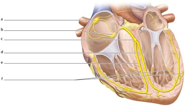   -Identify the structure labeled e.
