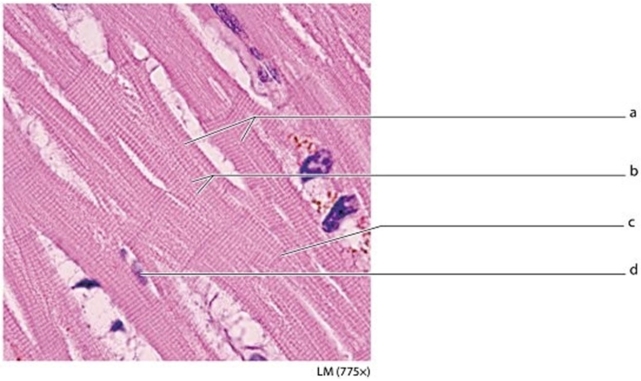   -Identify the structure on the micrograph labeled c.