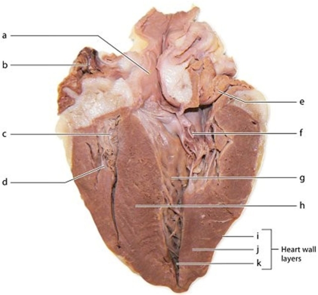   -Identify the structure labeled g.