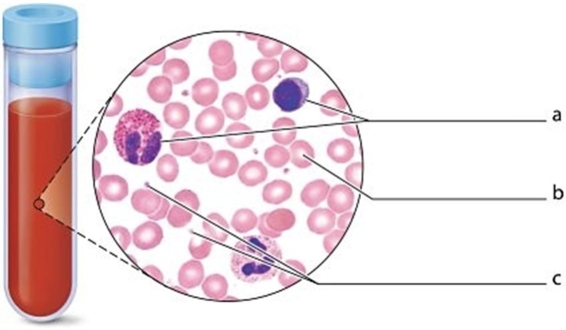   -Identify the structure labeled a.