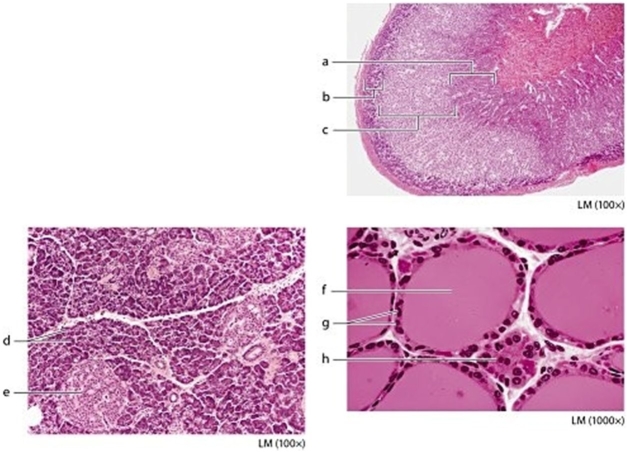   -Identify the structure on the micrograph labeled a.