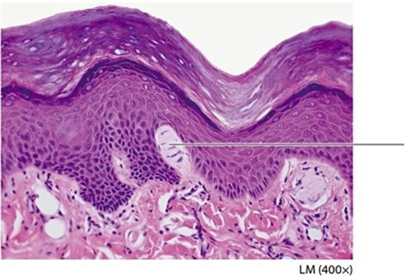 <strong> Examine the cutaneous receptor indicated by the pointer. What is the name of this structure?</strong> A)Lamellated (Pacinian)corpuscle B)Tactile (Meissner's)corpuscle C)Ruffini ending D)Merkel cell
