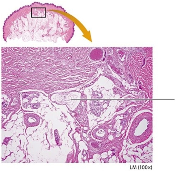 -Examine the cutaneous receptor indicated by the pointer. What is the name of this cutaneous receptor?
