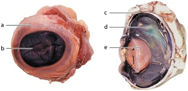   -Identify the structure labeled b.