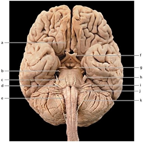   -Identify the nerve labeled c.