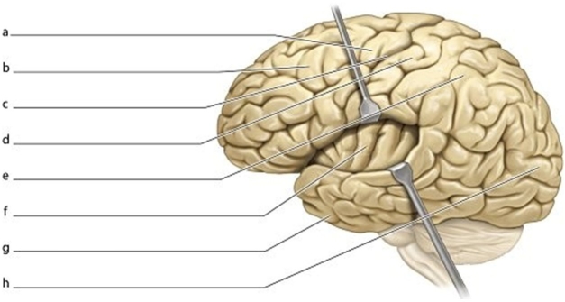<strong> Identify the structure labeled a.</strong> A)Postcentral gyrus B)Temporal lobe C)Precentral gyrus D)Central sulcus