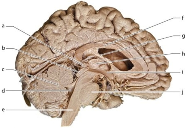   -Identify the structure labeled h.