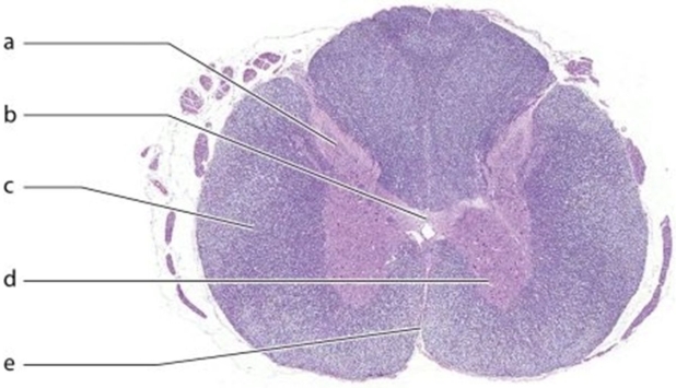   -Identify the structure labeled d.