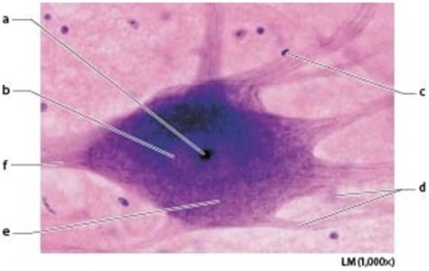 <strong> The cell body is marked by letter ________.</strong> A)C B)D C)E D)F