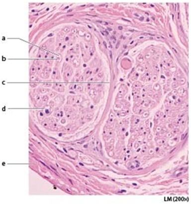 <strong> Letter e is marking the ________.</strong> A)perineurium B)endoneurium C)epineurium D)fascicle