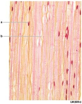 <strong> Letter b is marking the ________.</strong> A)fascicle B)neurofibrils C)node of Ranvier D)telodendria